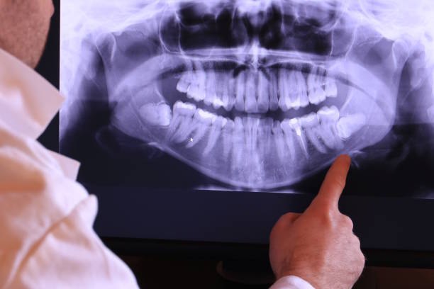 Best Emergency Treatment for Dental Infections or Abscesses in Eidson Road, TX
