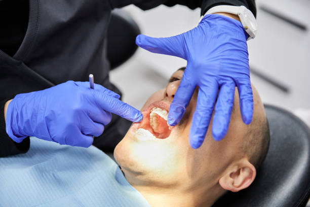 Best Emergency Dental Care for Broken or Chipped Teeth in Eidson Road, TX